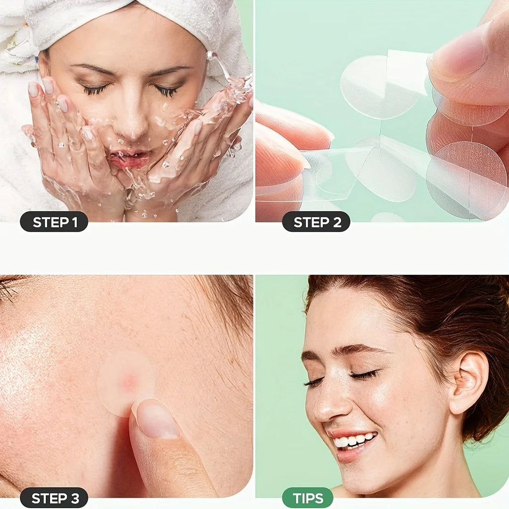 400/800pcs HITWORKER Hydrocolloid Acne Patches, 2 Sizes, Day & Night Use, Beige, Oil Control, Fragrance-Free